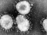 Coronavirus reduziert das Angebot des KSR